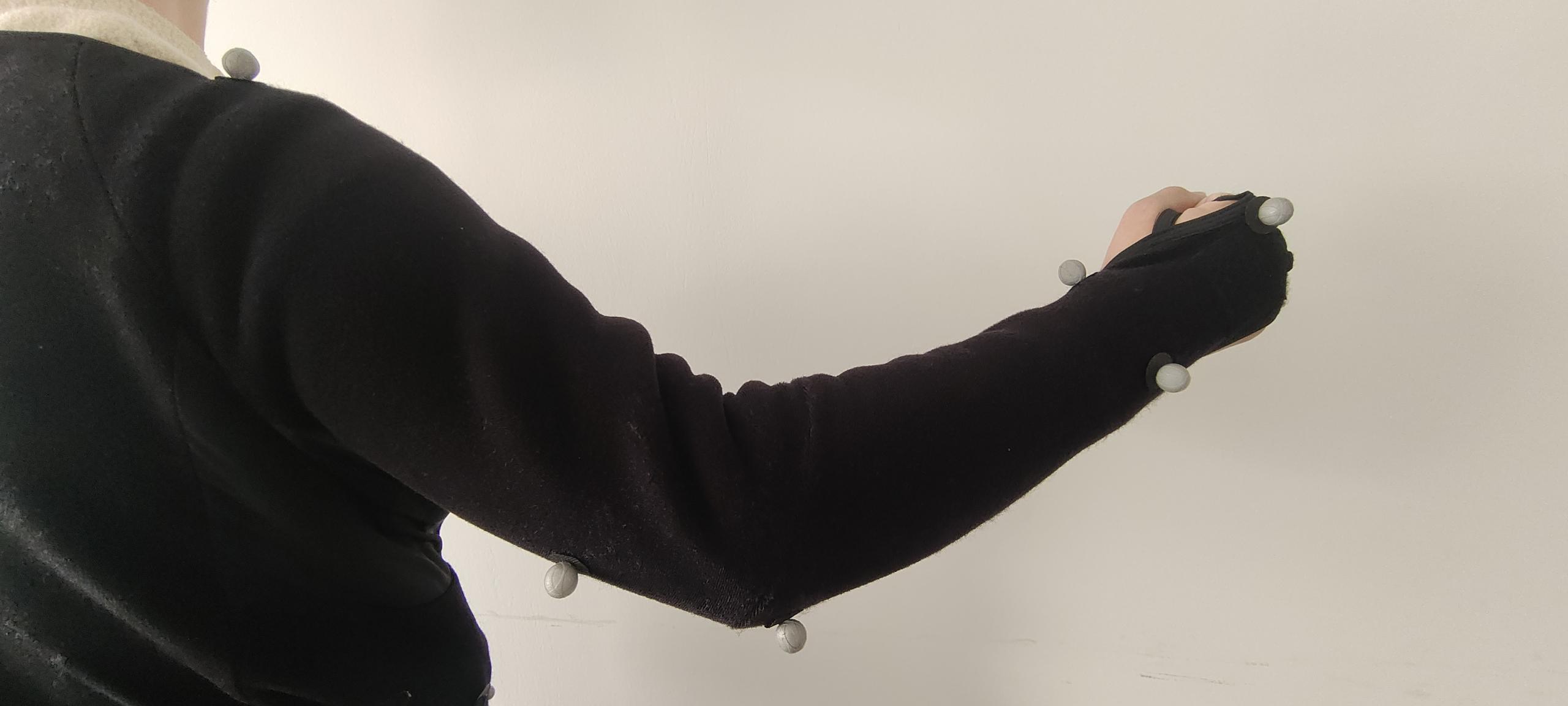 <em>Right Arm View</em>